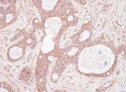p62/SQSTM1 Antibody, Novus Biologicals 0.1mg; Unlabeled:Antibodies, Polyclonal